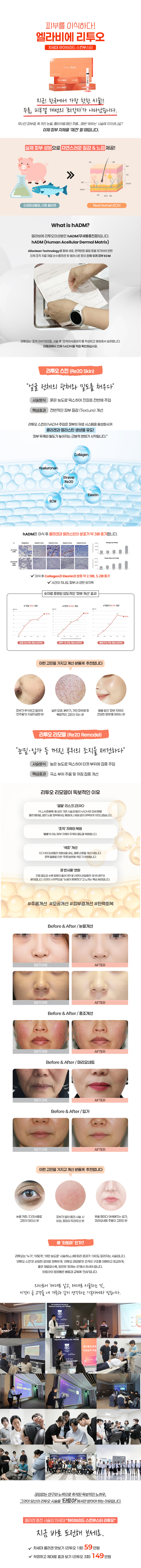 엘라비에 리투오